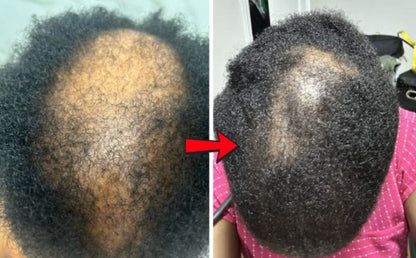 😍 Pure Batana – Boost Your Hair Growth in Just a Few Weeks!